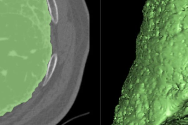 header-Sviluppo-di-algoritmi-automatici-3D-per-la-segmentazione-e-la-classificazione-di-immagini-biomediche-