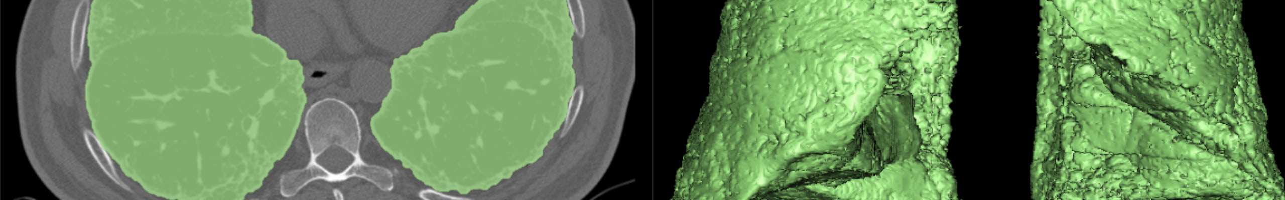 header-Sviluppo-di-algoritmi-automatici-3D-per-la-segmentazione-e-la-classificazione-di-immagini-biomediche-