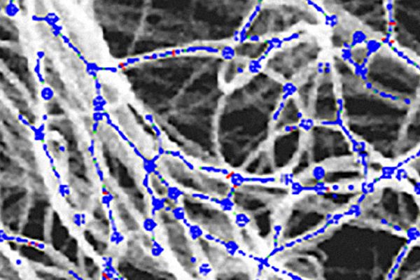 NET-IBA-2