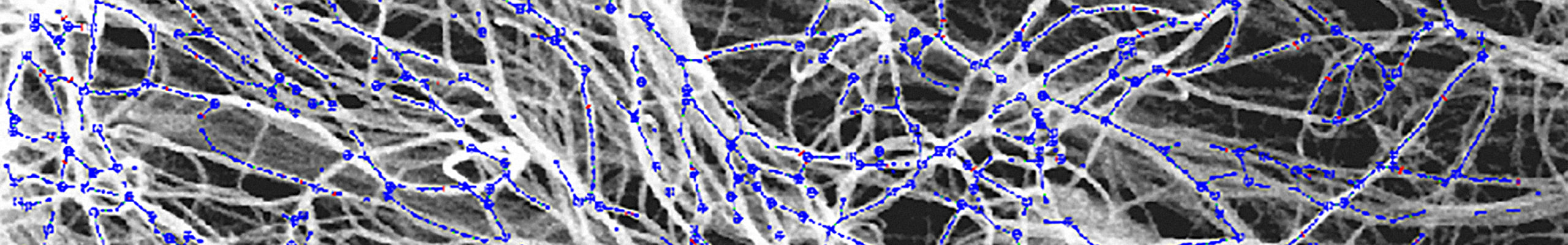 NET-IBA-2