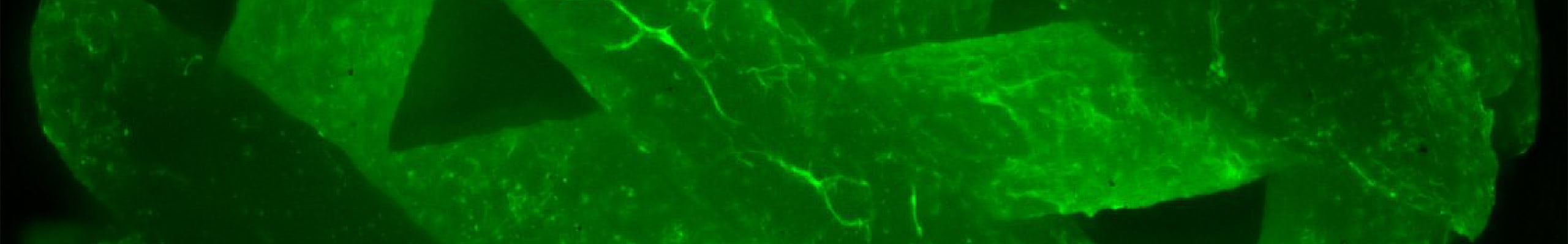 OActive---Advanced-computational-model,-personalized,-ancd-multiscale-to-prevent-OsteoArthritis