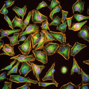 header-High-throughput-Screening-mobile-300x300